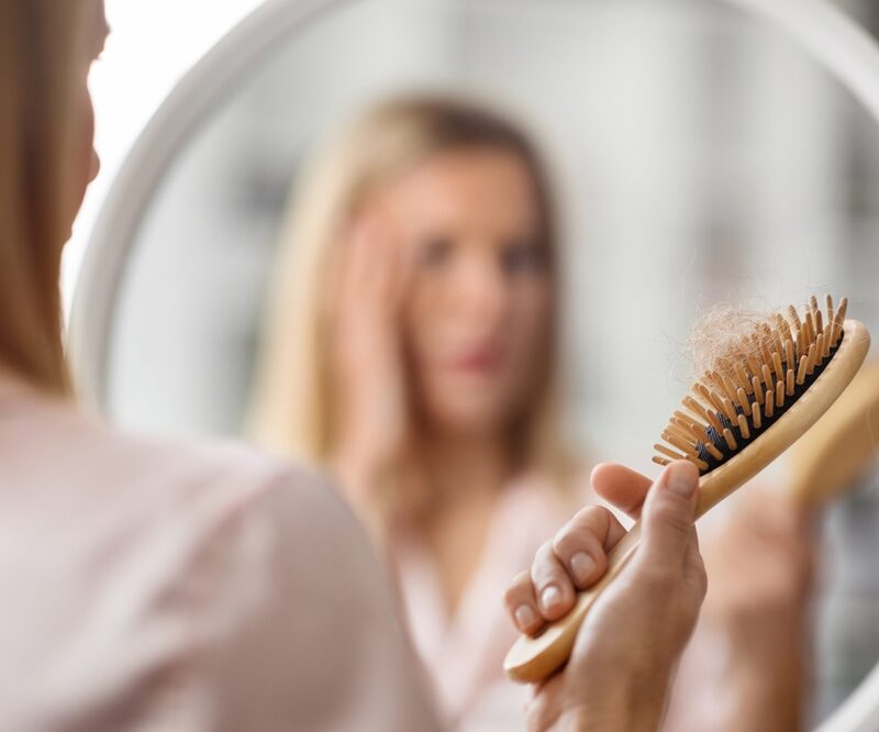 How do dermatologists diagnose different types of alopecia?