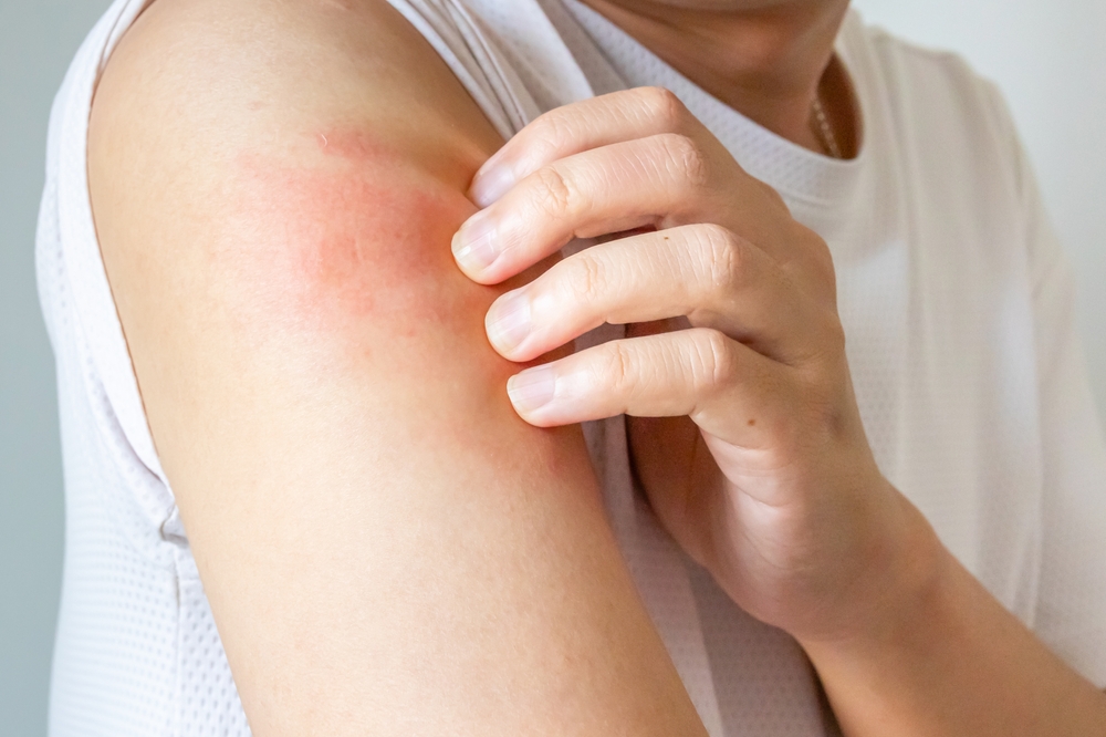Can skin allergies be causing your unexplained rashes and itching?
